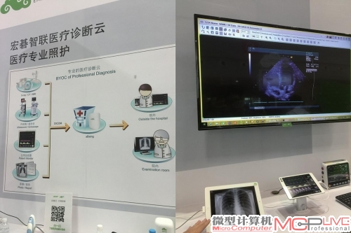 宏碁现场展示了与合作厂商的自建云应用，包括远程智联诊断和医疗信息存储上报。